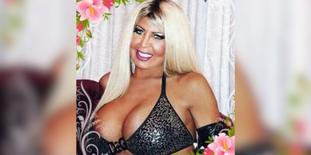 Silicone nos glúteos: Justiça decreta prisão de suspeita por procedimento