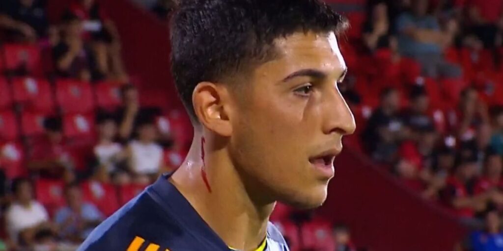 Caco de vidro acerta pescoço de goleiro do Boca Juniors, que sangra; vídeo