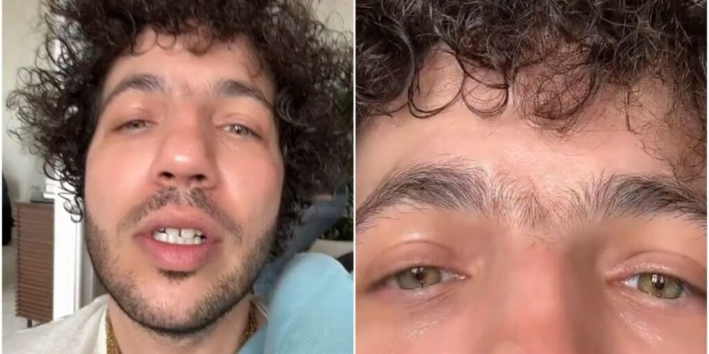 Noivo de Selena Gomez, Benny Blanco tira sobrancelha e mostra mudança