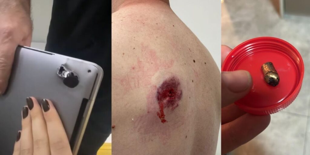 SP: Baleado durante assalto, homem sobrevive graças a notebook na mochila