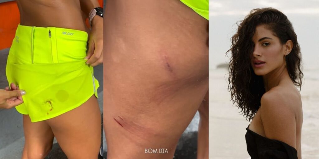 Quem é Letícia Salles, atriz atacada por cinco cães no RJ