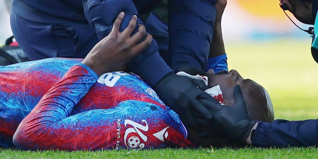 Após laceração na orelha, atacante francês terá que usar máscara protetora