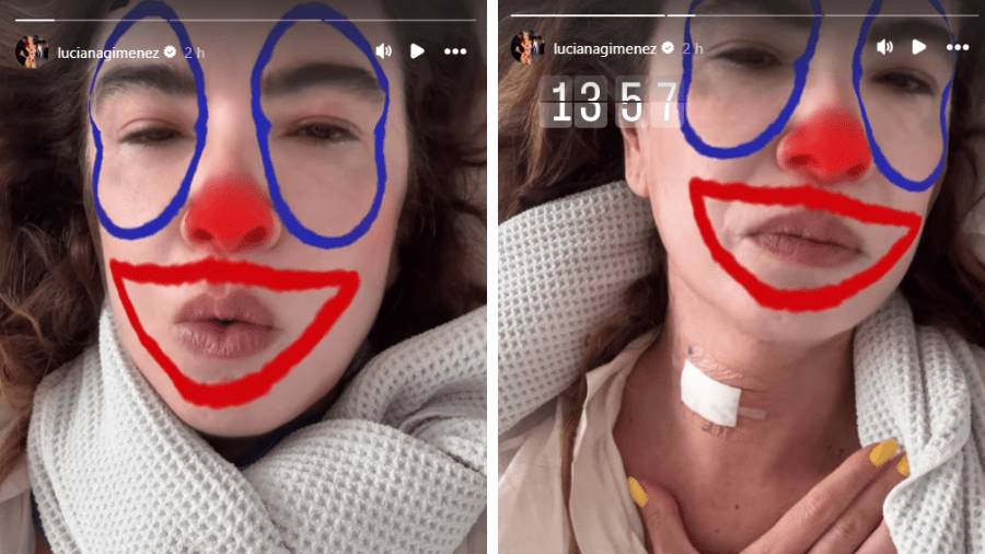 Luciana Gimenez desabafa após cirurgia: "Está sendo uma tortura"