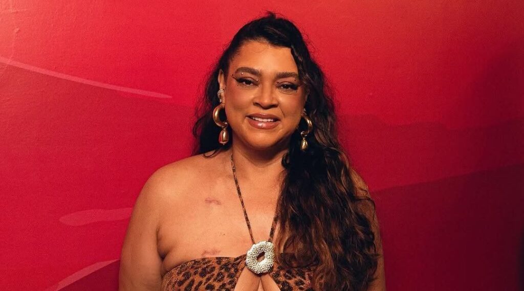 Preta Gil exibe cicatriz no abdômen no Carnaval de Salvador