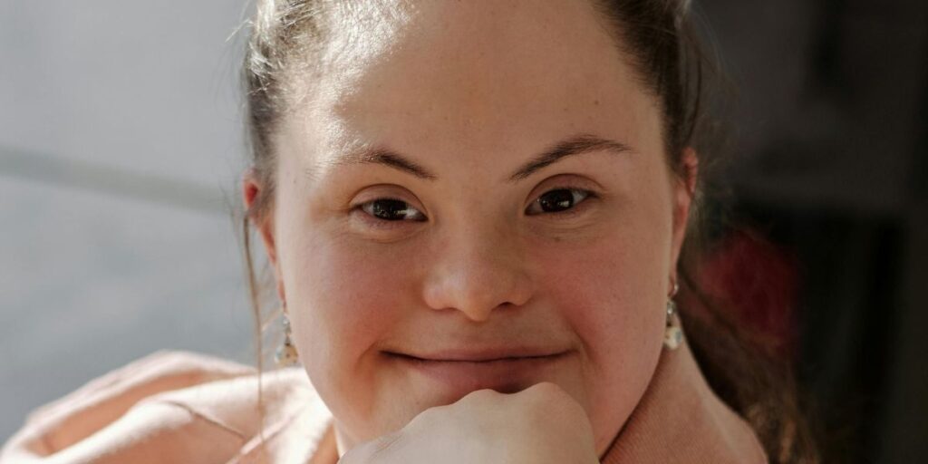 Ação de meias trocadas lembra Dia da Síndrome de Down; conheça