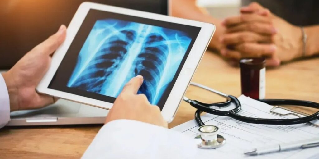 Dia Mundial da Tuberculose: saiba como é feito o diagnóstico da doença