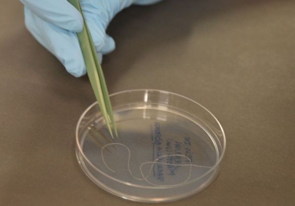 SP: 15 pessoas tiveram contato com "superfungo" no Hospital do Servidor