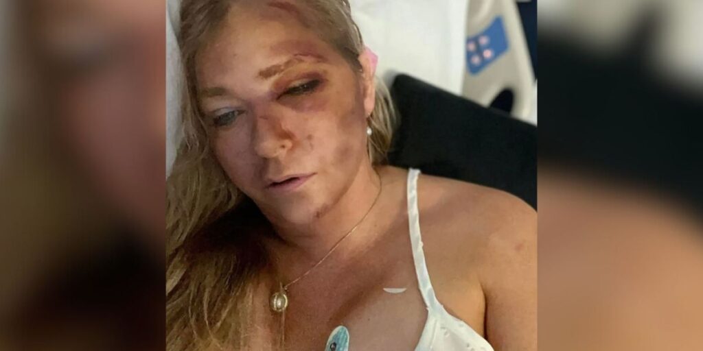 Mulher que acusou príncipe Andrew sofre acidente com ônibus escolar