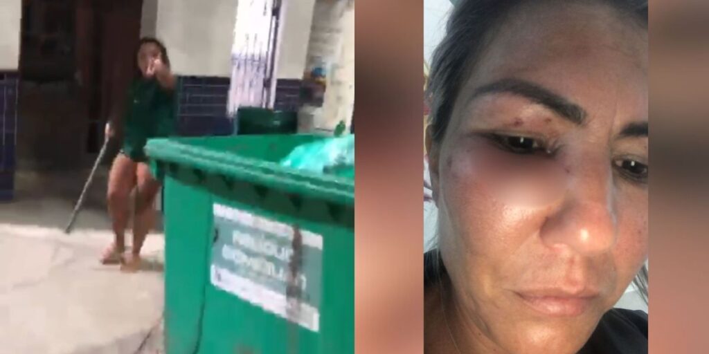 Motorista de app diz que passageira a agrediu após não pagar corrida no RJ