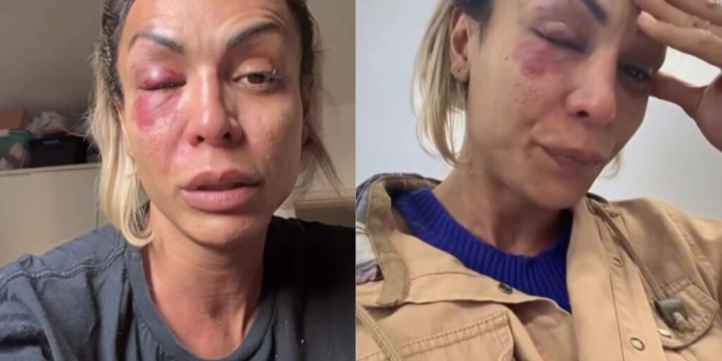 Vídeo: ativista trans é agredida por homem em condomínio de São Paulo