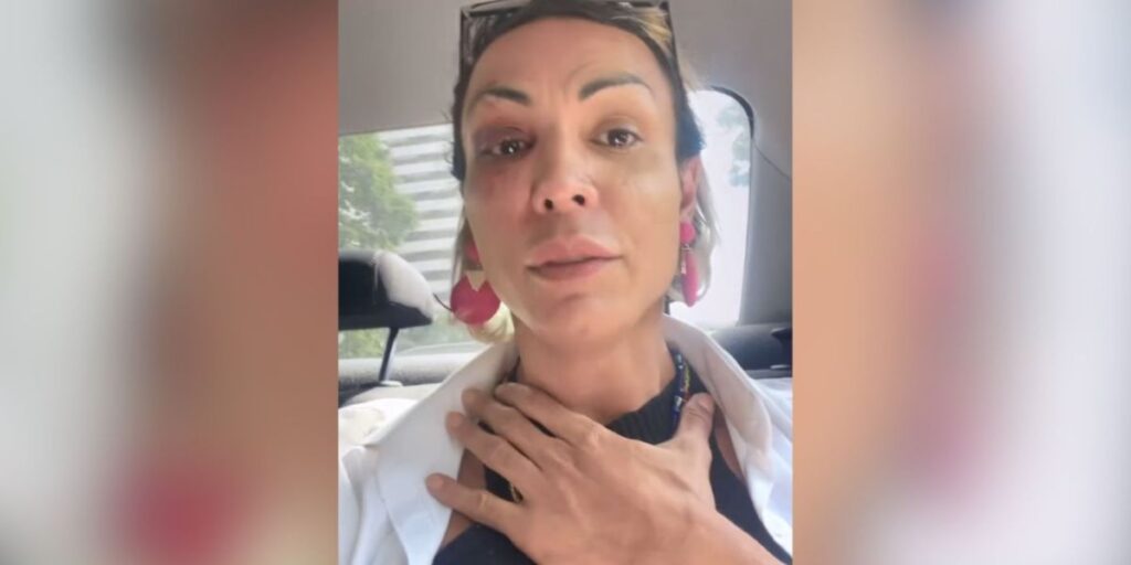 Trans agredida reconhece agressor; polícia tenta identificar suspeito