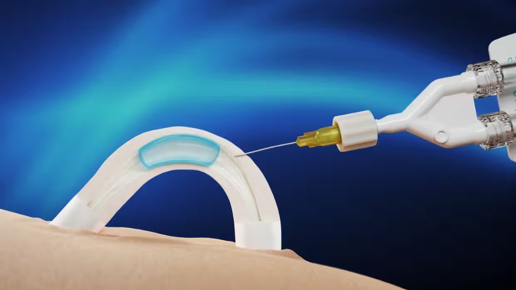 Contraceptivo masculino por implante avança em testes na Austrália