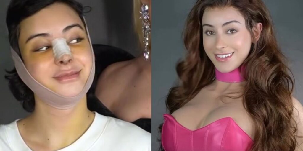 Influencer relata processo de transição: "Me despeço do Zé Longuinho"