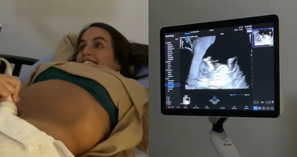 Grávida de Thiaguinho, Carol Peixinho mostra ultrassom; confira