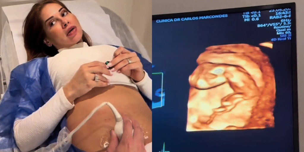 Grávida, Maíra Cardi explica motivo de ter dois médicos
