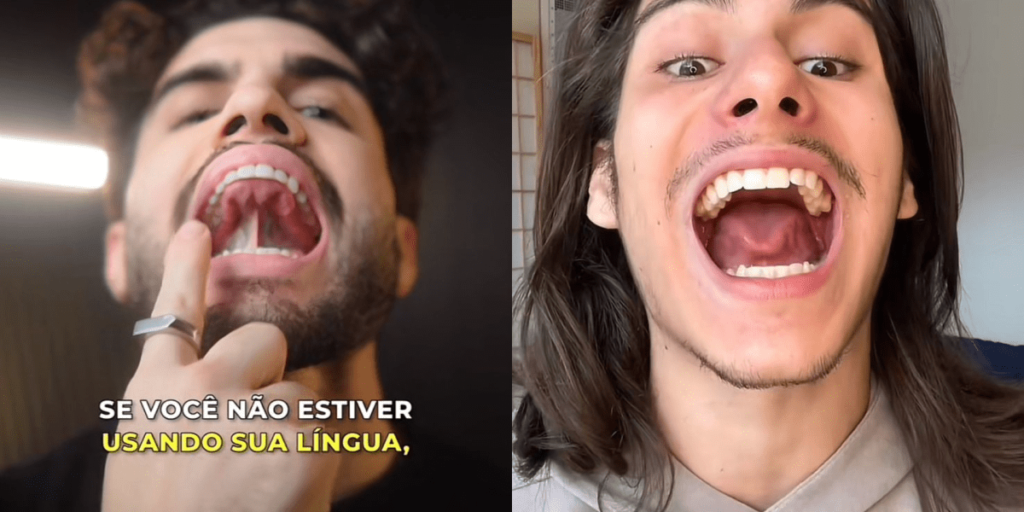 Mewing define o mandíbula? Conheça riscos do exercício viral do TikTok