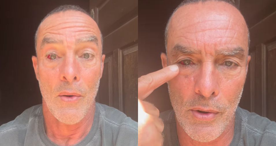 Paulo Zulu sofre derrame ocular após incidente com o filho; entenda