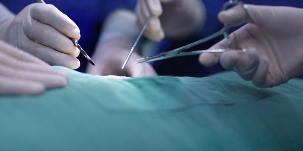 Múltiplos transplantes: entenda cuidados e consequências